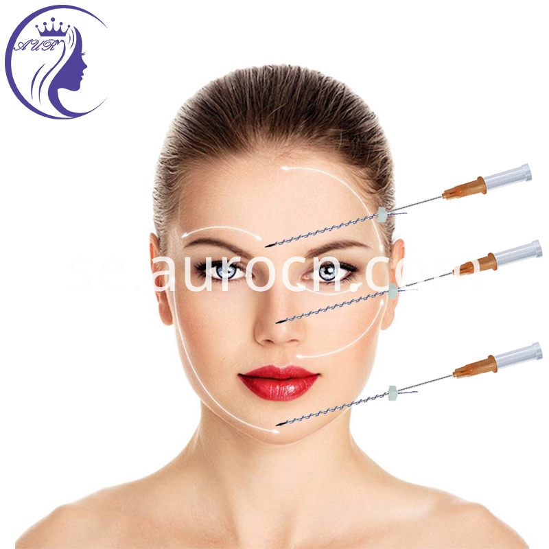 6 Absorbable Pdo Lifting Thread